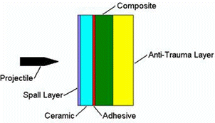 [Layers: ceramic, composite, anti-trauma]